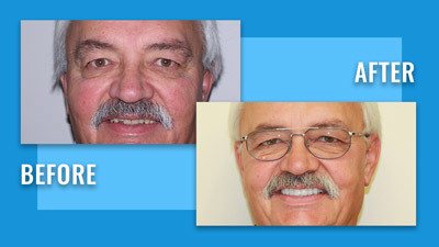 Before & After | Edmonton General Dentist | Sana Dental | Edmonton, AB